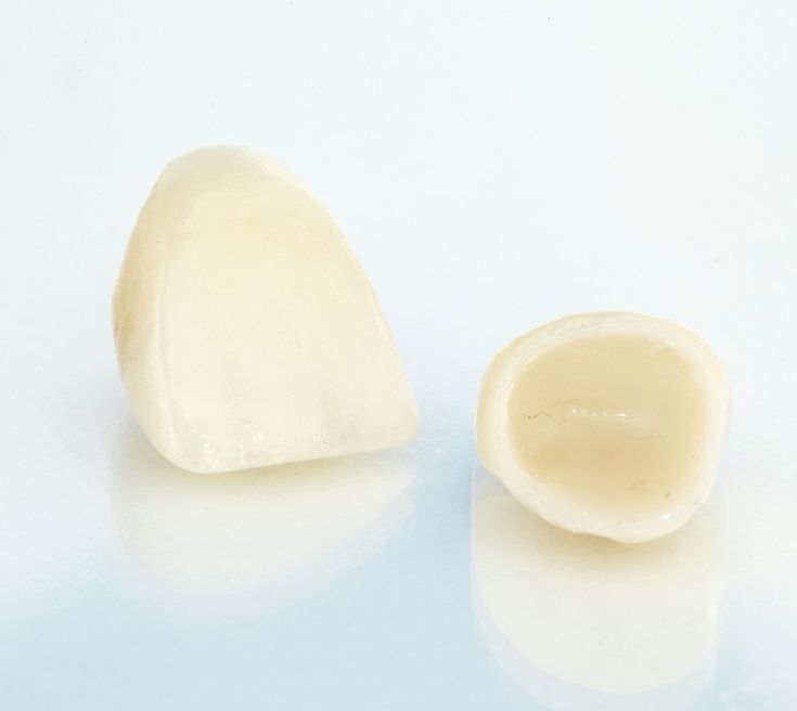 Răng sứ toàn sứ